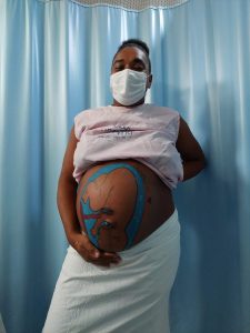 Paciente da maternidade ganha pintura gestacional